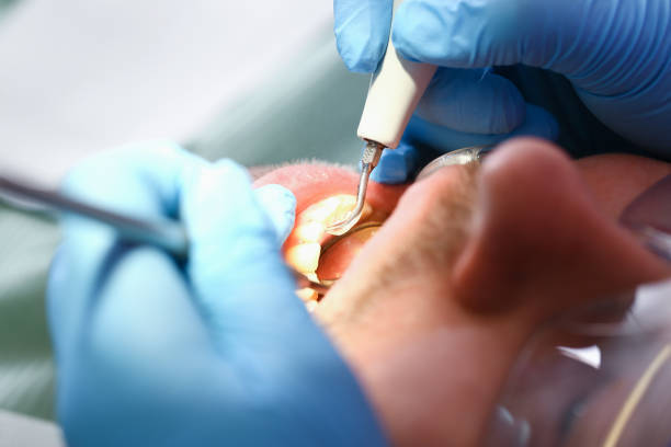 Best Emergency Treatment for Dental Infections or Abscesses in Crystal City, TX