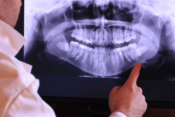 Best Emergency Treatment for Dental Infections or Abscesses in Crystal City, TX